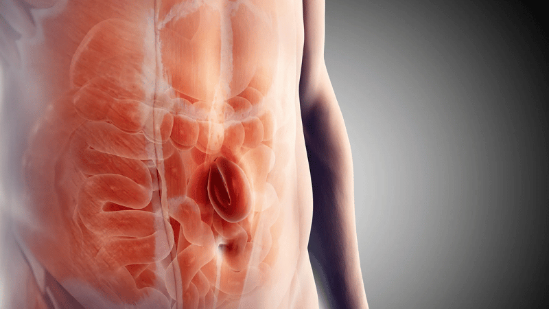 hernia types surgery laparoscopic robotic repair bengaluru