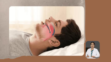 Obstructive Sleep Apnea