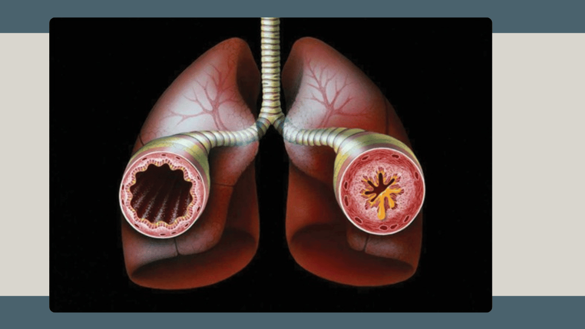 https://d2vvc091k8tmib.cloudfront.net/s3fs-public/2026-09/Allergic%20Rhinitis%20and%20Airway%20Allergic%20Disorders.png