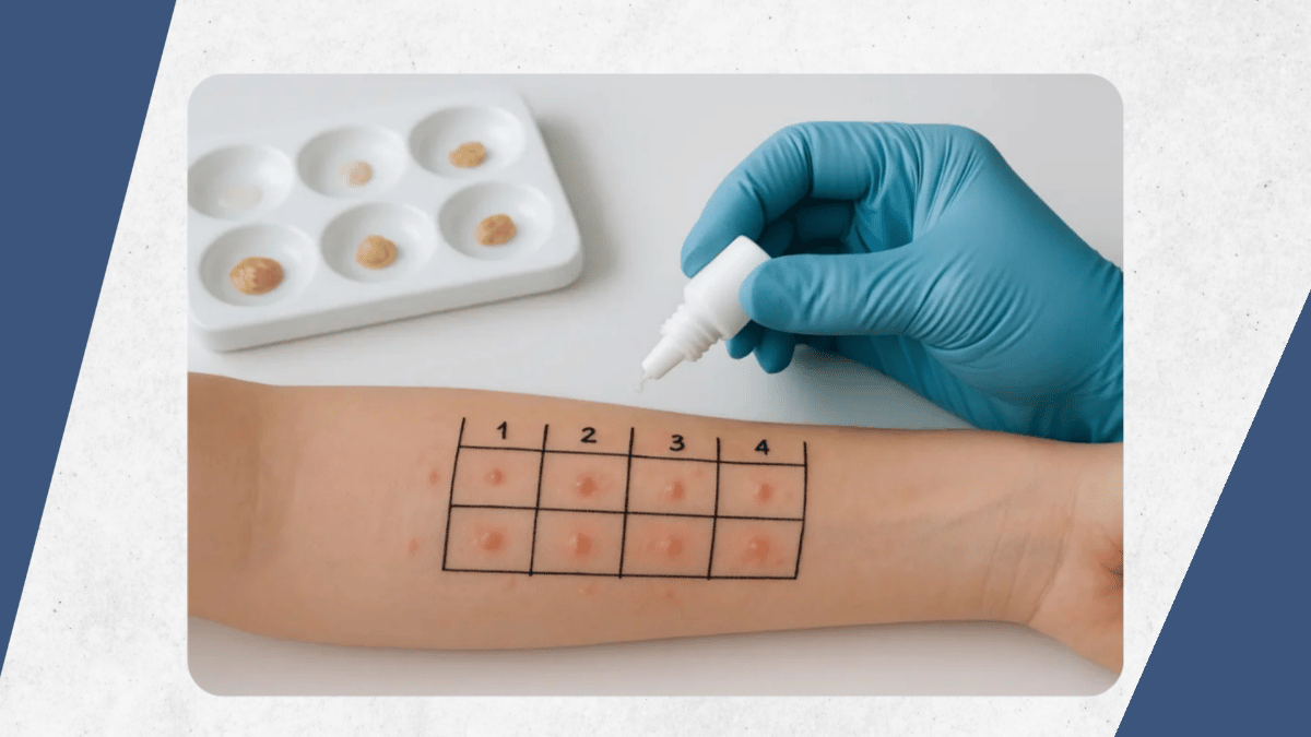 Allergy Testing: What the Results Actually Mean and How They Guide Treatment