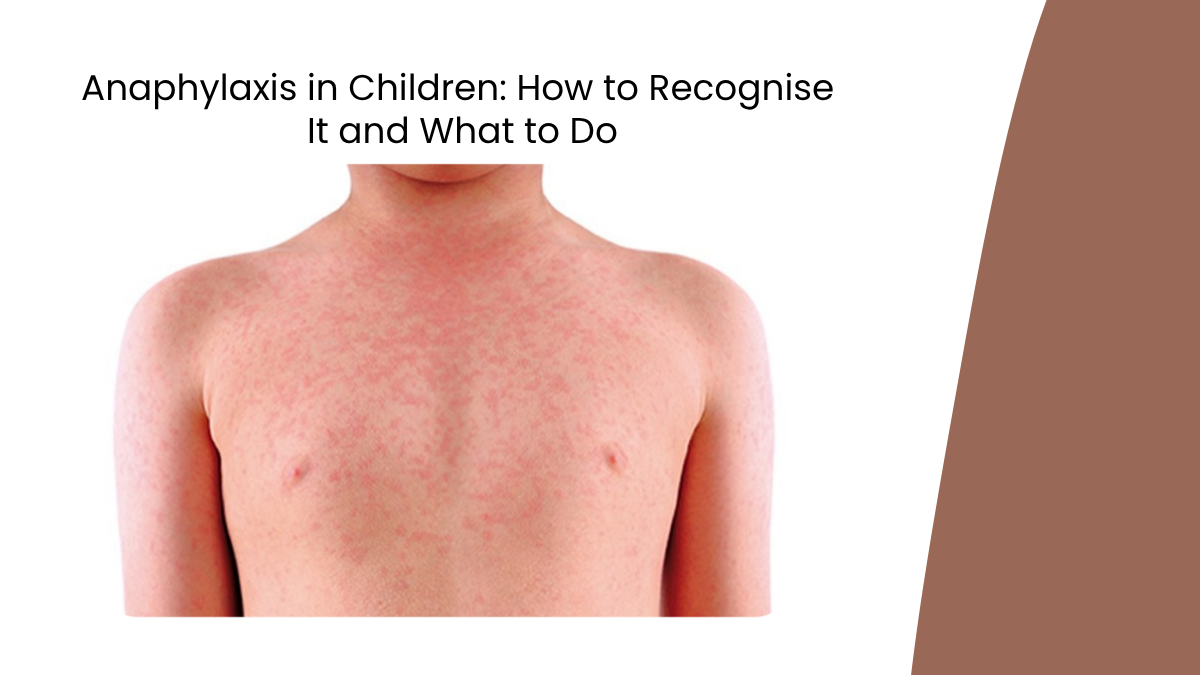 anaphylaxis children recognition emergency management guwahati