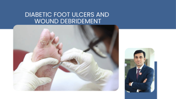 Diabetic Foot Ulcers and Wound Debridement: Why Surgical Assessment Cannot Wait