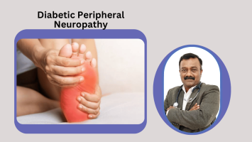 Diabetic Peripheral Neuropathy: Why the Nerves in Your Feet Need Attention