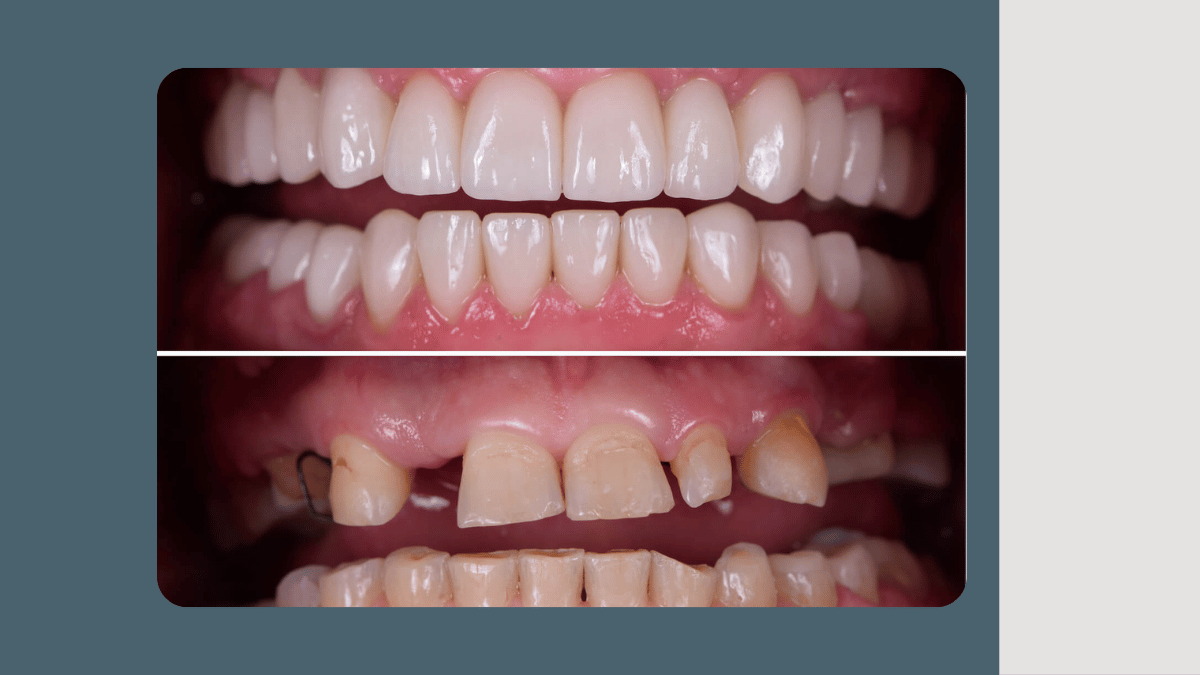 https://d2vvc091k8tmib.cloudfront.net/s3fs-public/2026-09/Full-Mouth%20Rehabilitation.png