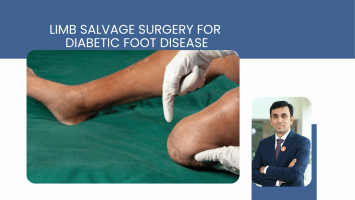 Limb Salvage Surgery for Diabetic Foot Disease: Why Timing Determines the Outcome