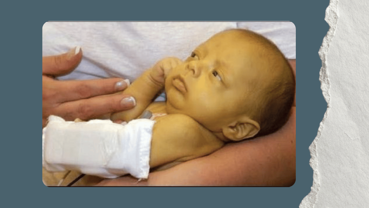 https://d2vvc091k8tmib.cloudfront.net/s3fs-public/2026-09/Neonatal%20Jaundice%20A%20Neonatologist%27s%20Guide%20to%20What%20Parents%20Need%20to%20Know.png