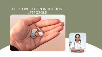 PCOS Ovulation Induction Letrozole