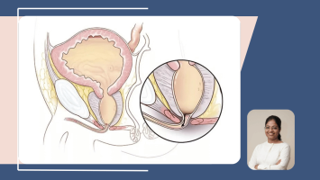 PUV Diagnosis: Why Antenatal Detection Changes What Happens to the Kidneys