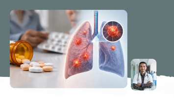 Targeted Therapy and SBRT for EGFR and ALK Lung Cancer Oligoprogression