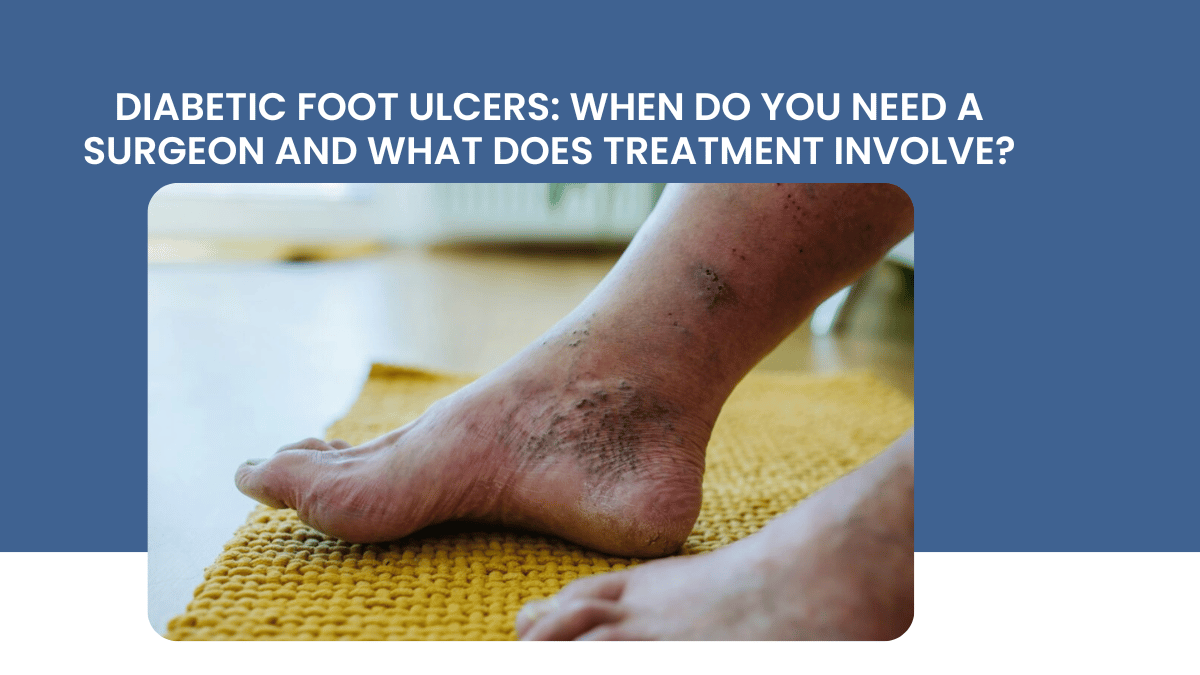 diabetic foot ulcer surgeon treatment jayanagar