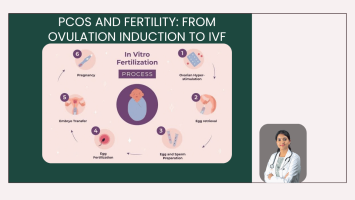 PCOS and Fertility: From Ovulation Induction to IVF